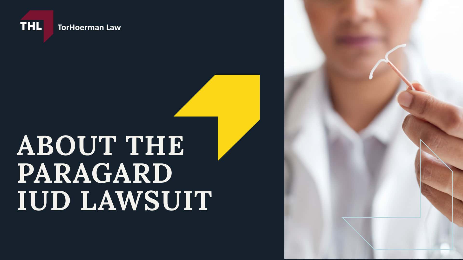 Paragard Migration Injury Lawsuit - About The Paragard Intrauterine Device (IUD) - torhoerman law; Paragard Migration Injury Lawsuit - Understanding Paragard IUD Migration - torhoerman law; Paragard Migration Injury Lawsuit - The Dangers of Paragard IUD Migration - torhoerman law; Paragard Migration Injury Lawsuit - Treatment Options for Paragard IUD Migration - torhoerman law; Paragard Migration Injury Lawsuit - About The Paragard IUD Lawsuit - torhoerman law