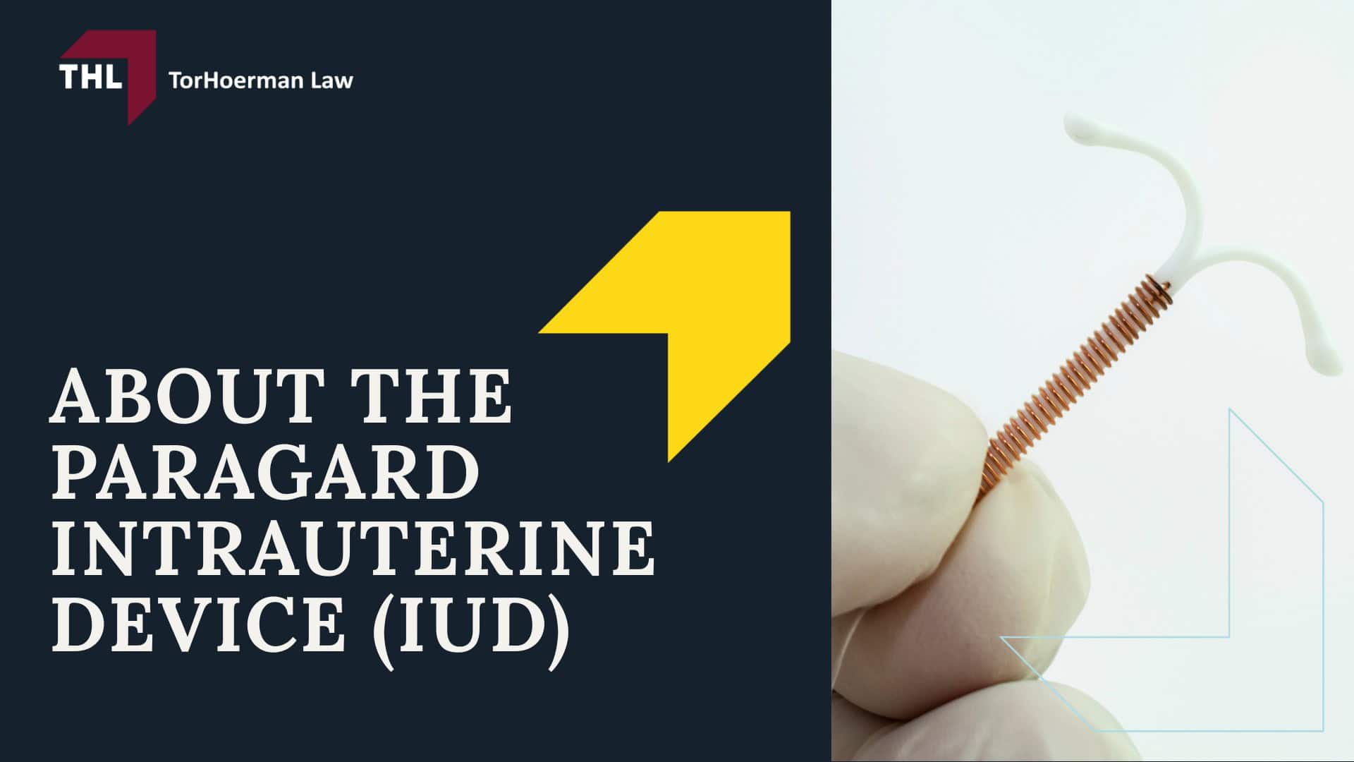 Paragard Migration Injury Lawsuit - About The Paragard Intrauterine Device (IUD) - torhoerman law