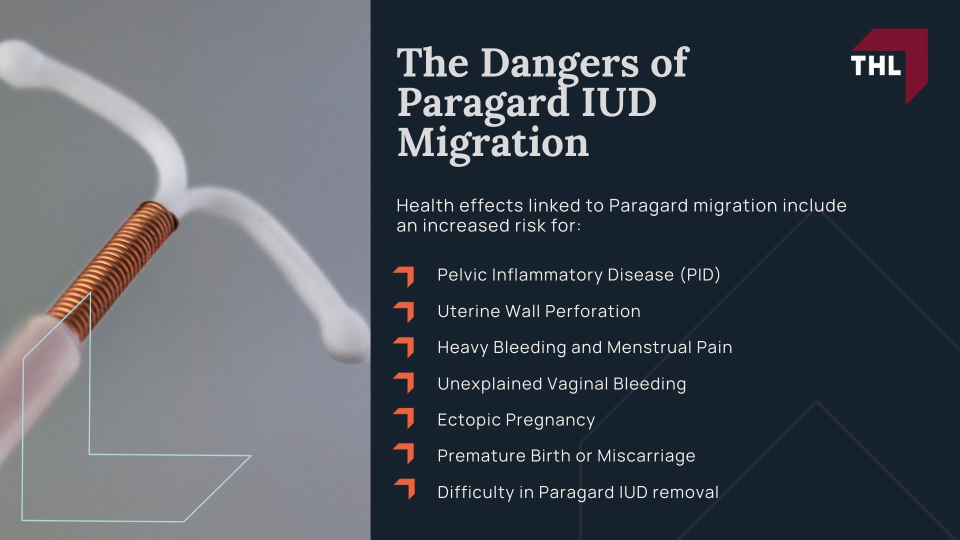 Paragard Migration Injury Lawsuit - About The Paragard Intrauterine Device (IUD) - torhoerman law; Paragard Migration Injury Lawsuit - Understanding Paragard IUD Migration - torhoerman law; Paragard Migration Injury Lawsuit - The Dangers of Paragard IUD Migration - torhoerman law