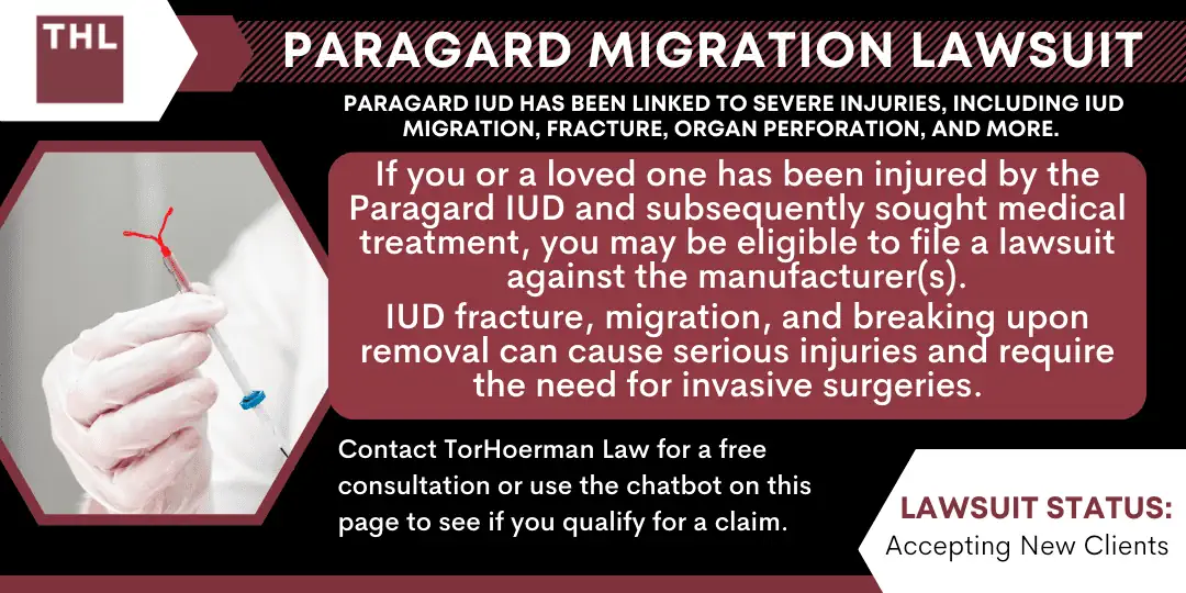 Paragard Migration Injury Lawsuit