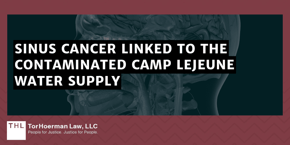 Camp Lejeune Sinus Cancer Lawsuit; Camp Lejeune Lawsuit; Camp Lejeune Water Contamination Lawsuit; Camp Lejeune Justice Act; Camp Lejeune Lawyers; Camp Lejeune Attorneys; Sinus Cancer Linked To The Contaminated Camp Lejeune Water Supply