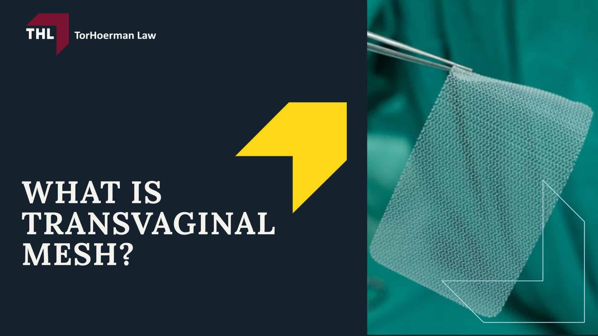 Transvaginal Mesh Settlement Amounts - Transvaginal Mesh Settlement Amounts - torhoerman law; Transvaginal Mesh Settlement Amounts - Past Settlements and Verdicts for Vaginal Mesh Lawsuits - torhoerman law; Transvaginal Mesh Settlement Amounts - What is Transvaginal Mesh_ - torhoerman law