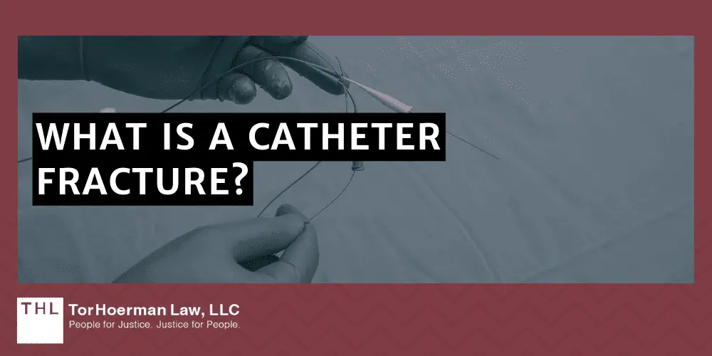 What Is A Catheter Fracture