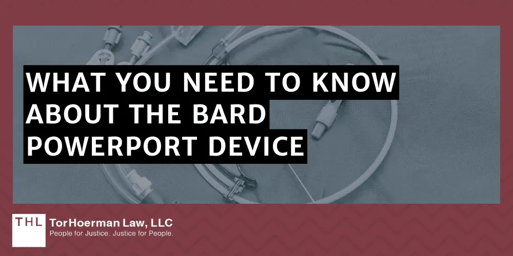 What You Need To Know About The Bard PowerPort Device