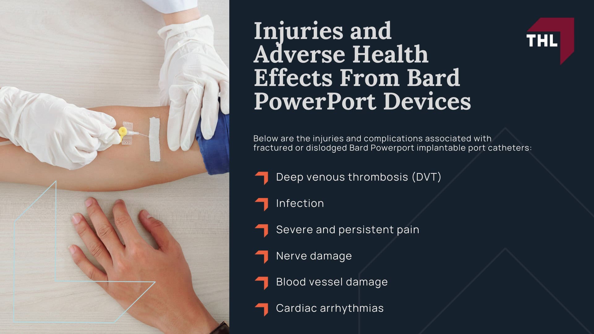 What Is the Bard PowerPort Device?; Bard PowerPort Device Malfunctions; Injuries and Adverse Health Effects From Bard PowerPort Devices