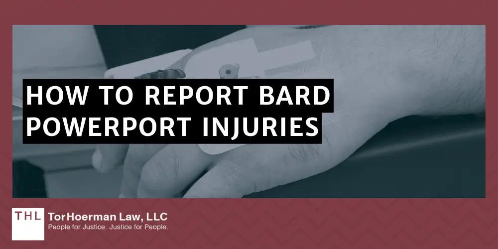 How to Report Bard PowerPort Injuries and Adverse Health Effects; Reporting Bard PowerPort Injuries; Bard PowerPort Lawsuit; Bard PowerPort Lawsuits; Bard PowerPort Lawyers; Bard Power Port Lawsuit; What Is The Bard PowerPort Device; Bard PowerPort Device Malfunctions; Injuries And Adverse Health Effects From Bard PowerPort Devices; How To Report Bard PowerPort Injuries