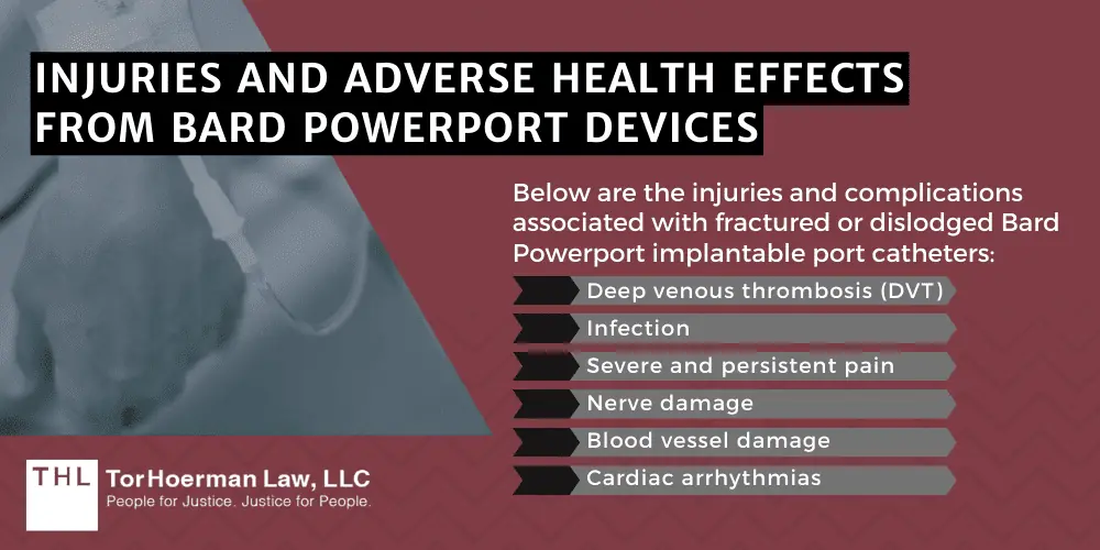 How to Report Bard PowerPort Injuries and Adverse Health Effects; Reporting Bard PowerPort Injuries; Bard PowerPort Lawsuit; Bard PowerPort Lawsuits; Bard PowerPort Lawyers; Bard Power Port Lawsuit; What Is The Bard PowerPort Device; Bard PowerPort Device Malfunctions; Injuries And Adverse Health Effects From Bard PowerPort Devices
