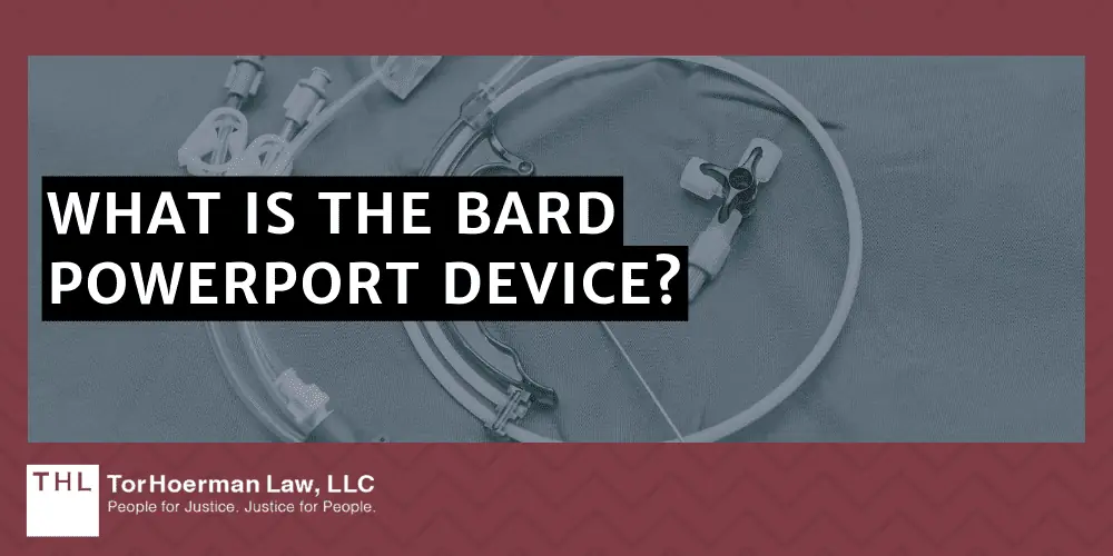 How to Report Bard PowerPort Injuries and Adverse Health Effects; Reporting Bard PowerPort Injuries; Bard PowerPort Lawsuit; Bard PowerPort Lawsuits; Bard PowerPort Lawyers; Bard Power Port Lawsuit; What Is The Bard PowerPort Device