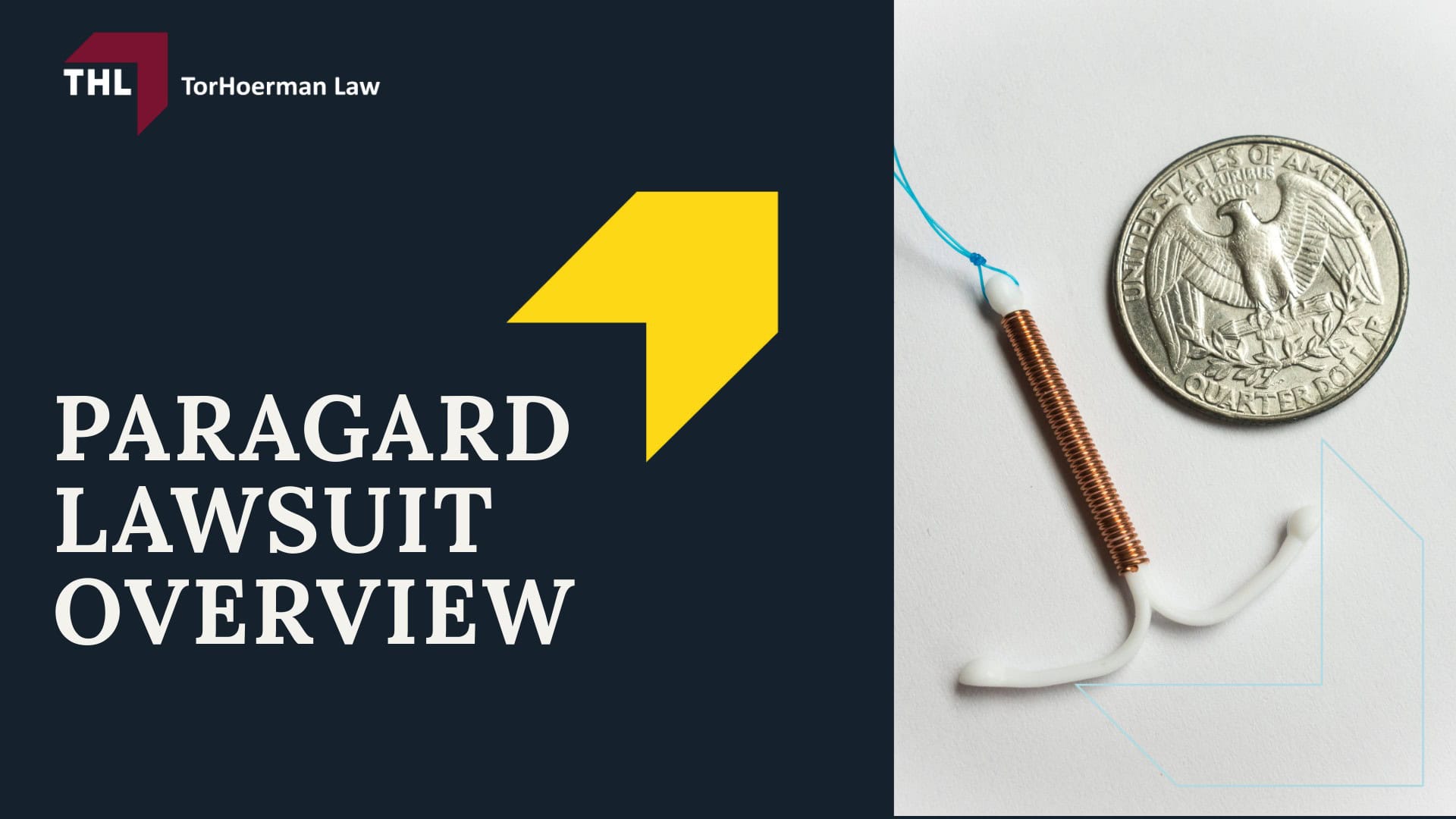 Potential for Paragard IUD Breakage During Removal; FAQ Can I File a Lawsuit if My IUD Broke During Removal - What is the Paragard Copper IUD - torhoerman law; FAQ Can I File a Lawsuit if My IUD Broke During Removal - Paragard Lawsuit Overview - torhoerman law