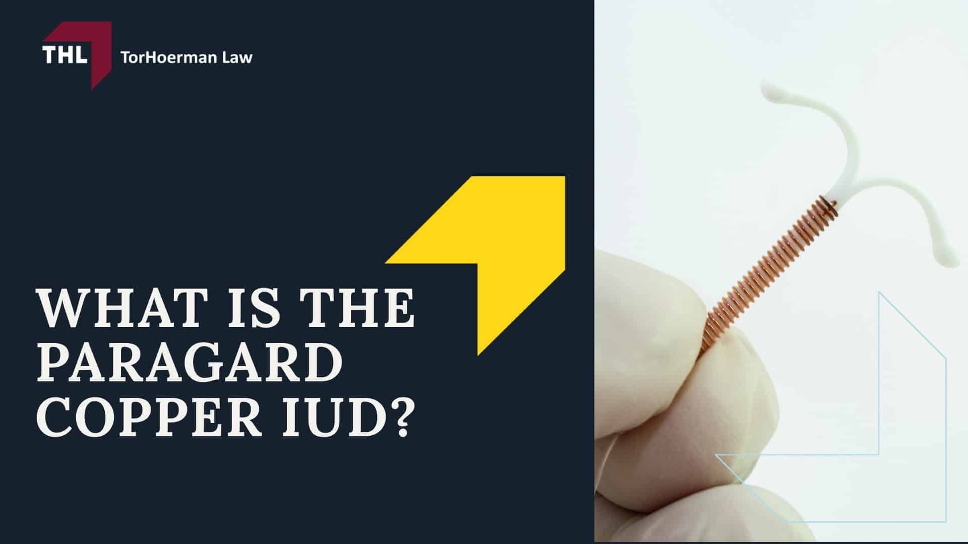 Potential for Paragard IUD Breakage During Removal; FAQ Can I File a Lawsuit if My IUD Broke During Removal - What is the Paragard Copper IUD - torhoerman law