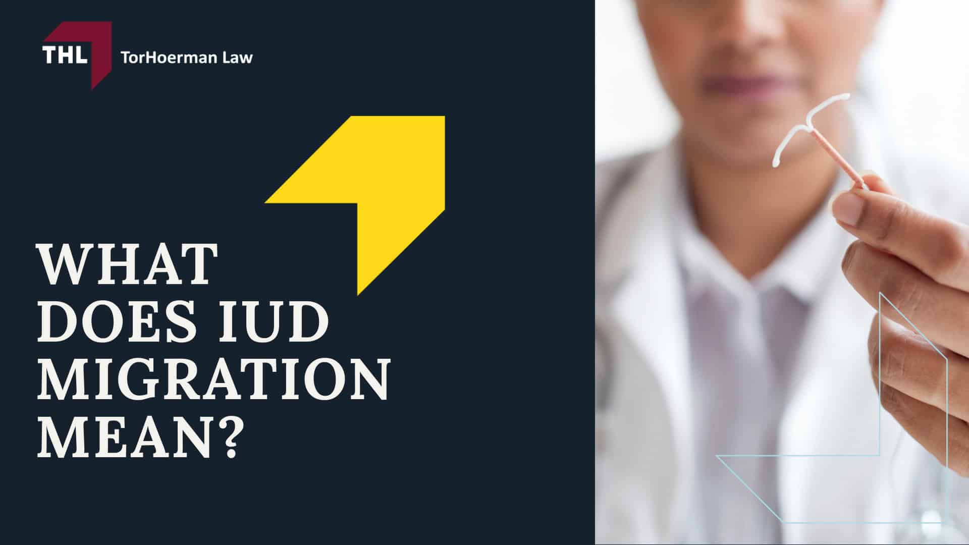 FAQ What Is the Surgical Treatment for IUD Migration - What Is the Paragard IUD - torhoerman law; FAQ What Is the Surgical Treatment for IUD Migration - Understanding IUD Migration - torhoerman law; FAQ What Is the Surgical Treatment for IUD Migration - What Does IUD Migration Mean - torhoerman law