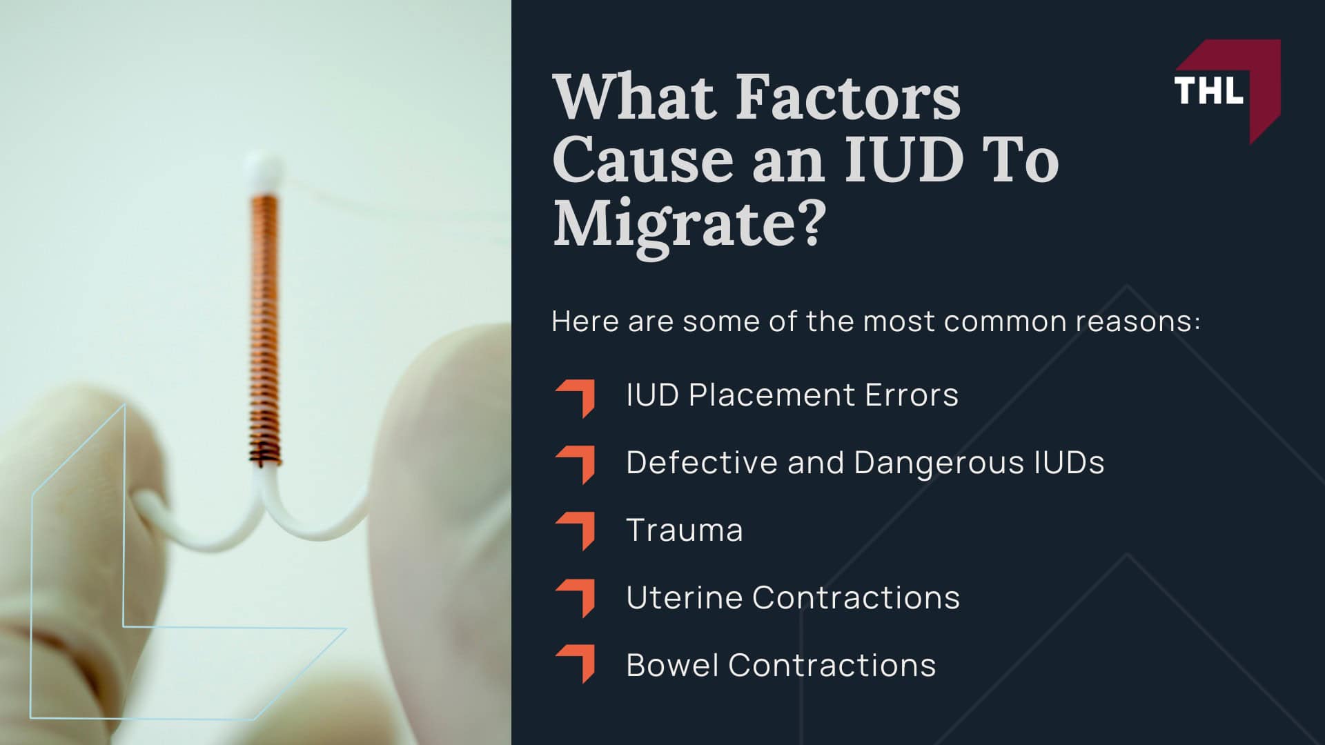 FAQ What Is the Surgical Treatment for IUD Migration - What Is the Paragard IUD - torhoerman law; FAQ What Is the Surgical Treatment for IUD Migration - Understanding IUD Migration - torhoerman law; FAQ What Is the Surgical Treatment for IUD Migration - What Does IUD Migration Mean - torhoerman law; FAQ What Is the Surgical Treatment for IUD Migration - What Are the Complications of IUD Migration - torhoerman law; FAQ What Is the Surgical Treatment for IUD Migration - What Factors Cause an IUD To Migrate - torhoerman law