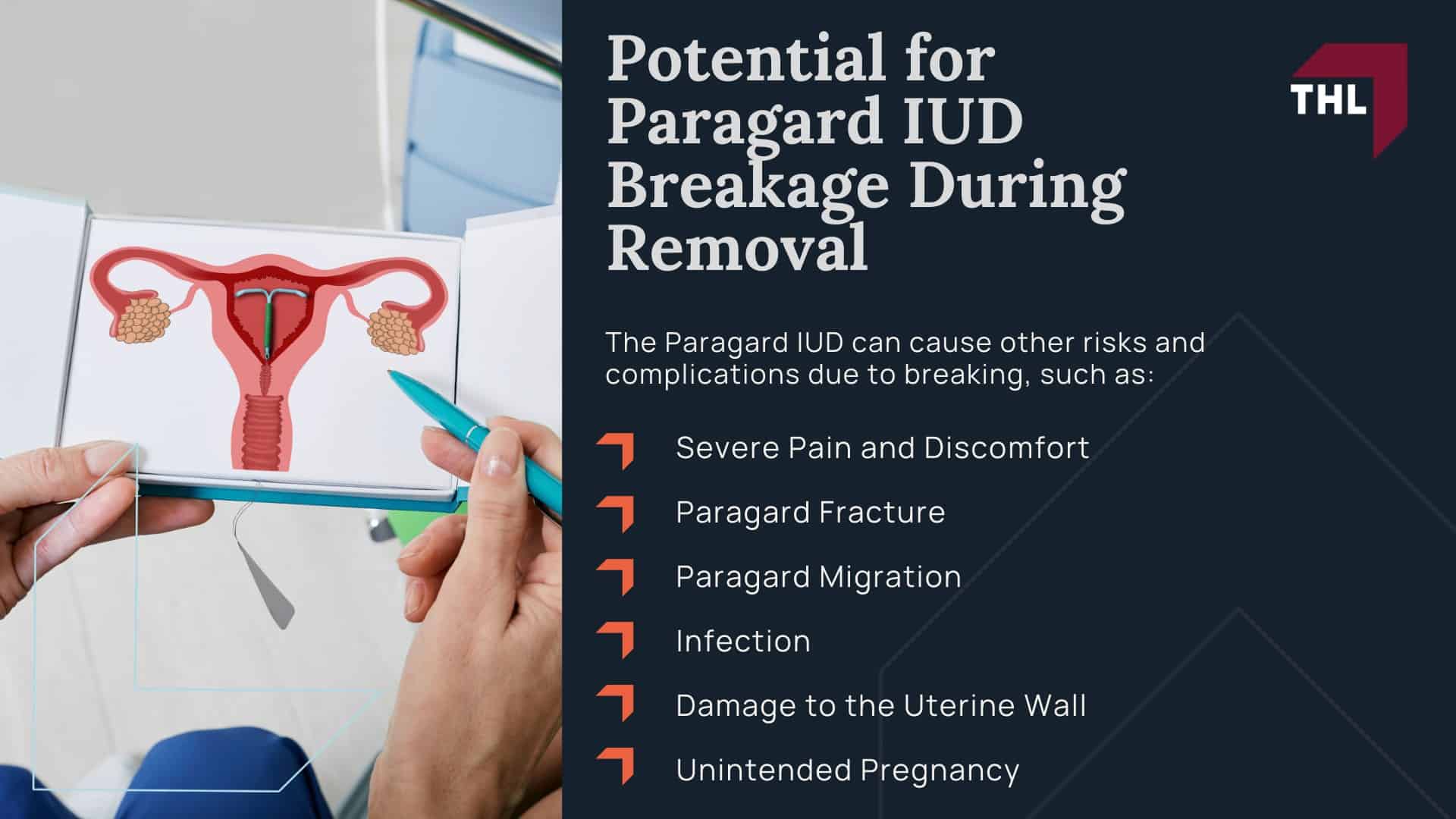 Potential for Paragard IUD Breakage During Removal