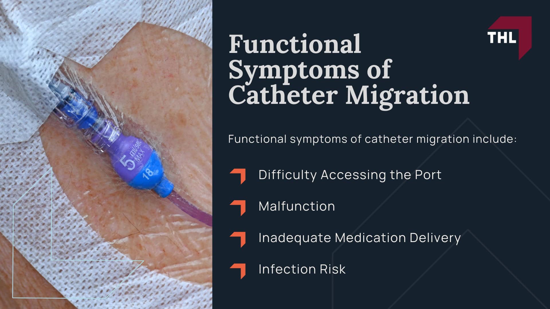 FAQ_ What are Port-a-Catheter Migration Symptoms_ - What Is Catheter Migration_ - torhoerman law; FAQ_ What are Port-a-Catheter Migration Symptoms_ - Physical Symptoms of Port-a-Catheter Migration - torhoerman law; FAQ_ What are Port-a-Catheter Migration Symptoms_ - Functional Symptoms of Catheter Migration - torhoerman law