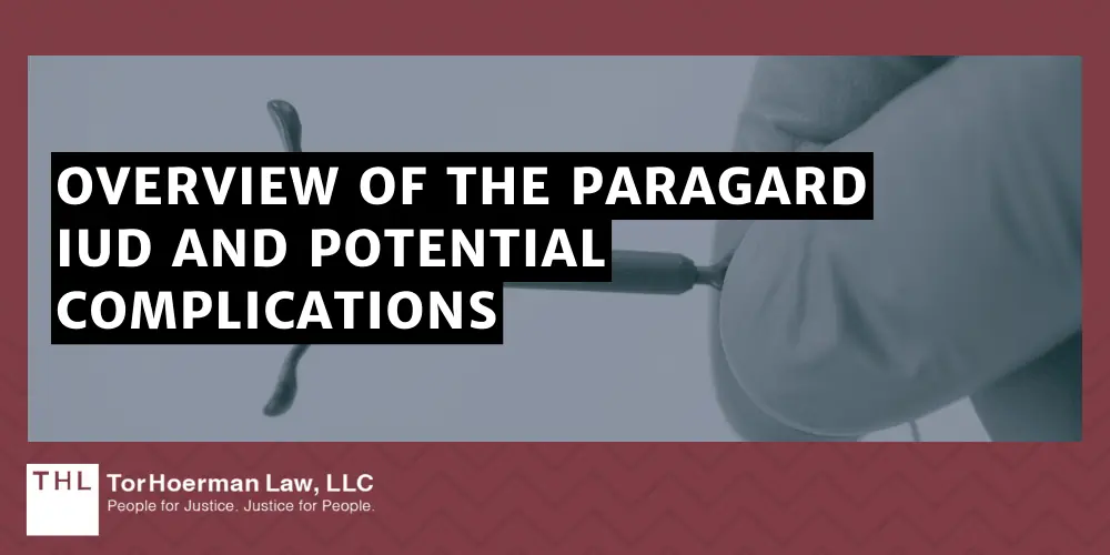 Can I File a Lawsuit if My IUD Broke During Removal; IUD Broke During Removal; Paragard Lawsuit; Paragard IUD Lawsuits; Paragard IUD Lawsuit; Overview Of The Paragard IUD And Potential Complications