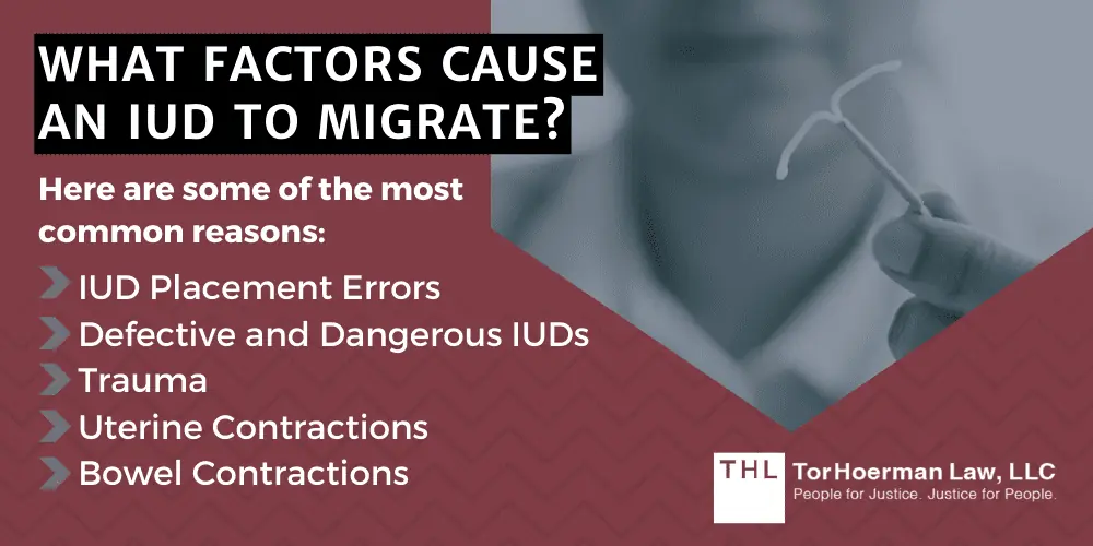 Surgical Treatment for IUD Migration; Paragard Lawsuit; Paragard IUD Lawsuit; Paragard Lawsuits; Paragard Lawyers; Paragard Migration; Paragard Fracture; Paragard MDL; What Is The Paragard IUD; Understanding IUD Migration; What Does IUD Migration Mean; What Are The Complications Of IUD Migration; What Factors Cause An IUD To Migrate