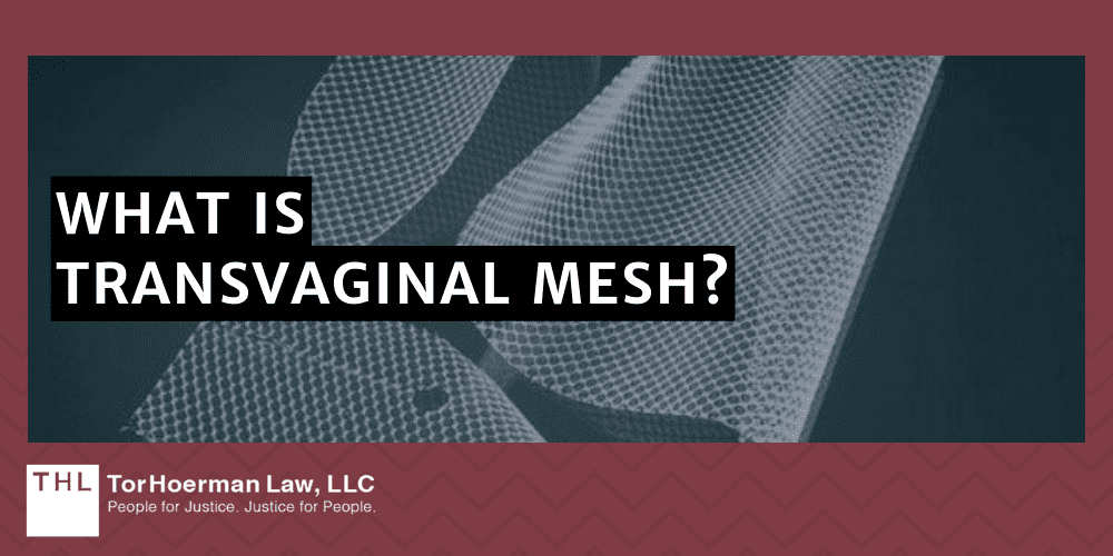 #1 Transvaginal Mesh Lawyers for Transvaginal Mesh Injuries; Transvaginal Mesh Injuries; Vaginal Mesh Lawsuit; Transvaginal Mesh Lawsuits; Transvaginal Mesh Lawyers; #1 Transvaginal Mesh Lawyers for Transvaginal Mesh Injuries; Transvaginal Mesh Injuries; Vaginal Mesh Lawsuit; Transvaginal Mesh Lawsuits; Transvaginal Mesh Lawyers; #1 Transvaginal Mesh Lawyers for Transvaginal Mesh Injuries; Transvaginal Mesh Injuries; Vaginal Mesh Lawsuit; Transvaginal Mesh Lawsuits; Transvaginal Mesh Lawyers