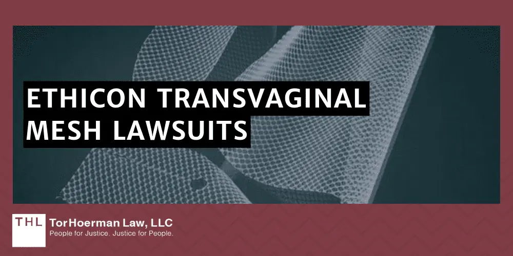 Ethicon Transvaginal Mesh Lawsuit; Transvaginal Mesh Lawsuits; Vaginal Mesh Lawsuit; Transvaginal Mesh Lawyers; Ethicon Transvaginal Mesh Lawsuit; Transvaginal Mesh Lawsuits; Vaginal Mesh Lawsuit; Transvaginal Mesh Lawyers