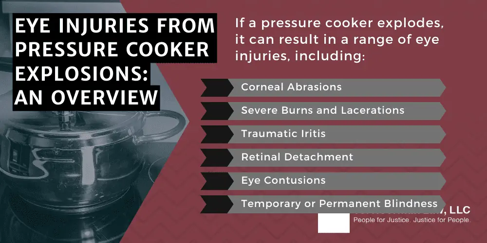 Eye Injuries From Pressure Cooker Explosions An Overview