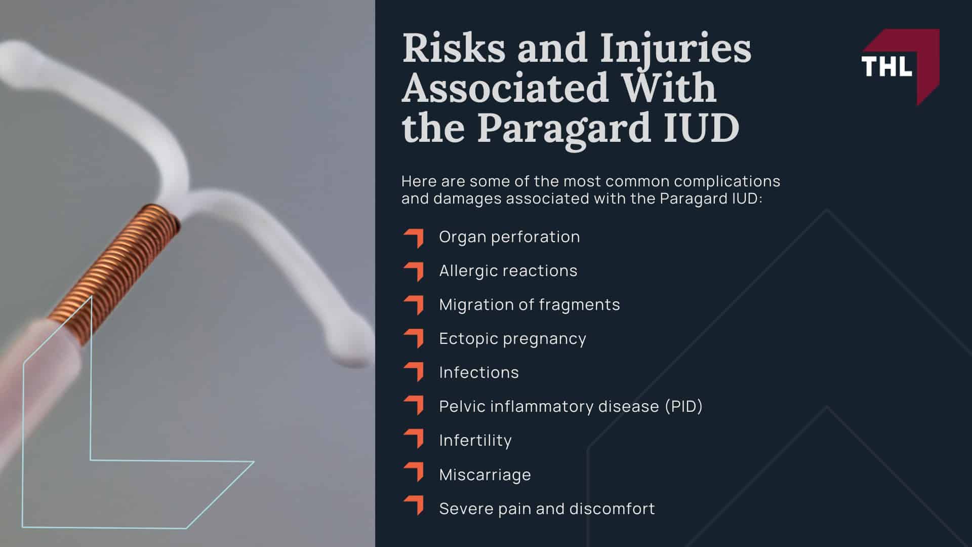 The Benefits of Hiring an Experienced Paragard Lawyer; FAQ What Are the Benefits of Hiring a Paragard Attorney - What You Need To Know About the Paragard Lawsuit - torhoerman law; FAQ What Are the Benefits of Hiring a Paragard Attorney - Overview of the Paragard IUD Lawsuit - torhoerman law (1); What You Need To Know About the Paragard Lawsuit