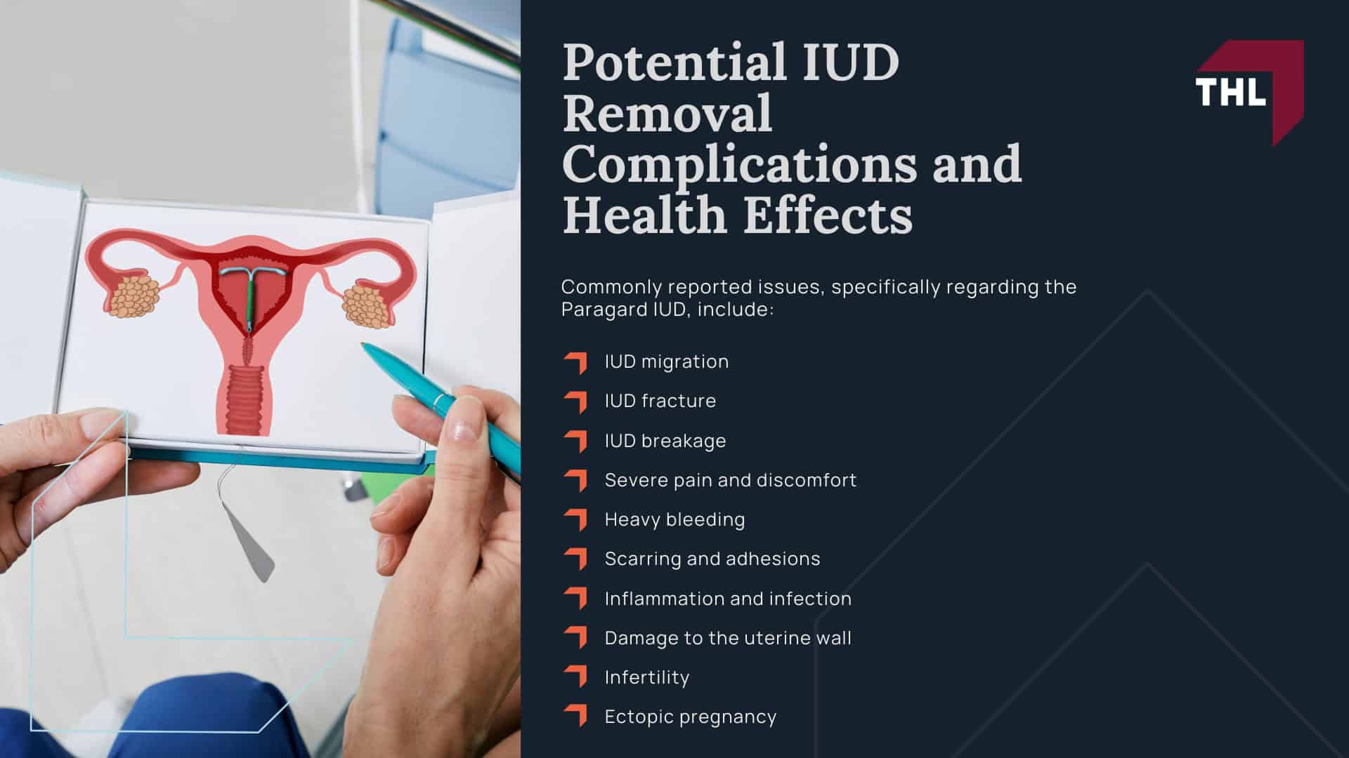 Paragard IUD Removal Complications - What Is an Intrauterine Device (IUD) - torhoerman law; Paragard IUD Removal Complications - The IUD Removal Process - torhoerman law; Paragard IUD Removal Complications - Potential IUD Removal Complications and Health Effects
