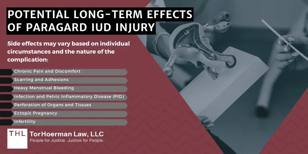 Paragard IUD Injury; Paragard Lawsuit; Paragard IUD Lawsuits; Paragard IUD Injury Lawsuits; Paragard Lawyers; What Is The Paragard IUD; How Do Paragard Injuries Occur; Potential Long-Term Effects Of Paragard IUD Injury