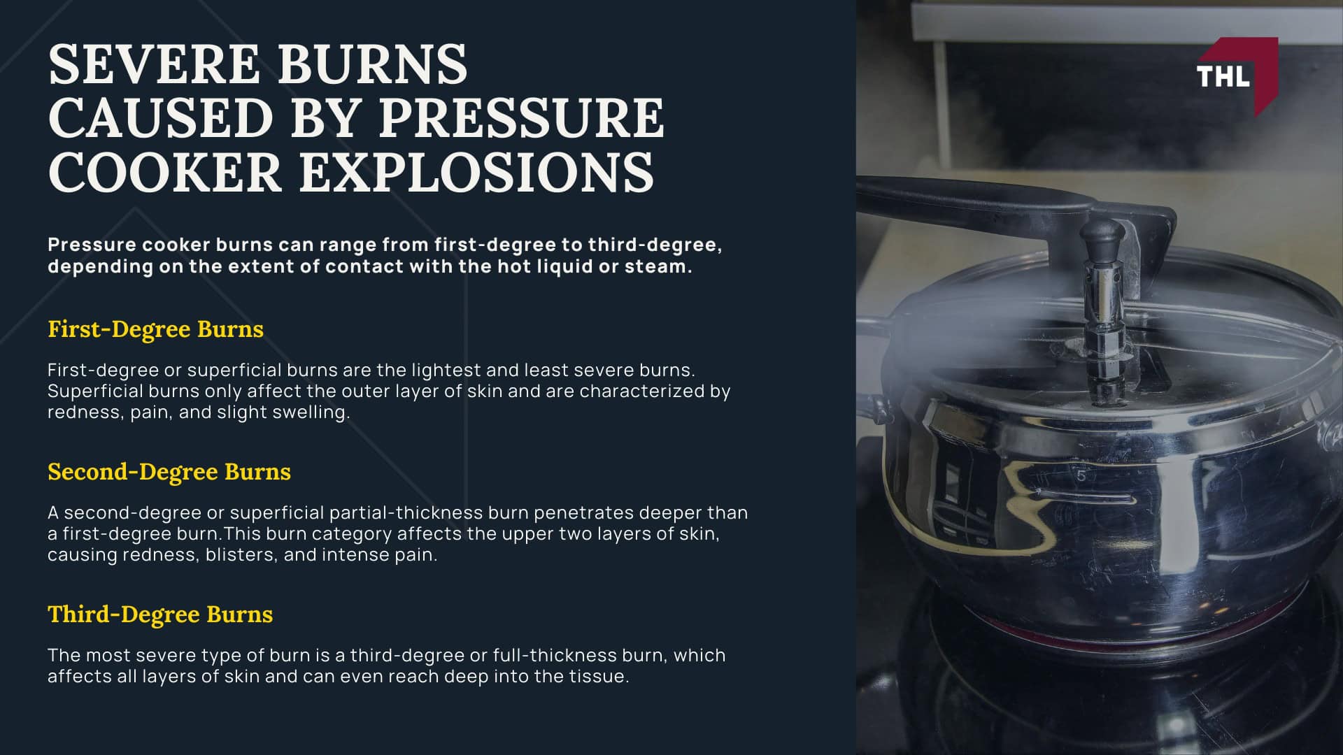 Pressure Cooker Burn Lawsuit - Severe Burns Caused by Pressure Cooker Explosions - torhoerman law; Pressure Cooker Burn Lawsuit - Severe Burns Caused by Pressure Cooker Explosions - torhoerman law
