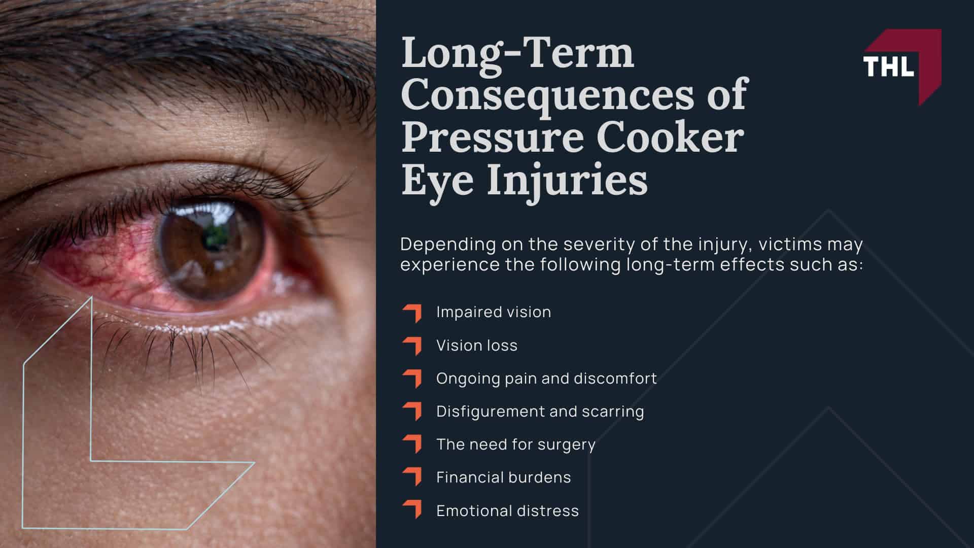 Pressure Cooker Eye Injury Lawsuit - Eye Injuries From Pressure Cooker Explosions_ An Overview - torhoerman law; Pressure Cooker Eye Injury Lawsuit - Long-Term Consequences of Pressure Cooker Eye Injuries - torhoerman law