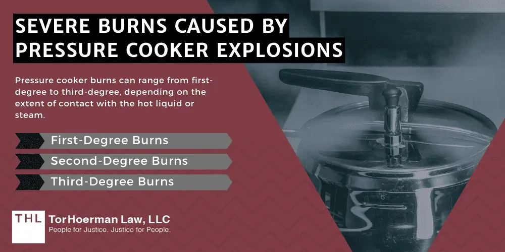 Severe Burns Caused By Pressure Cooker Explosions