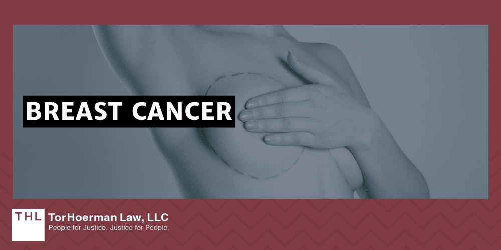 PCBs and Cancer; PCB Lawsuit; Monsanto PCB Lawsuit; Are PCBs Carcinogenic; Do PCBs Cause Cancer; PCB Exposure Lawsuit; Polychlorinated Biphenyls (PCBs) And Cancer; Mechanisms of Carcinogenesis How PCBs Cause Cancer; The Types Of Cancer Linked To PCB Exposures; Liver Cancer; Breast Cancer