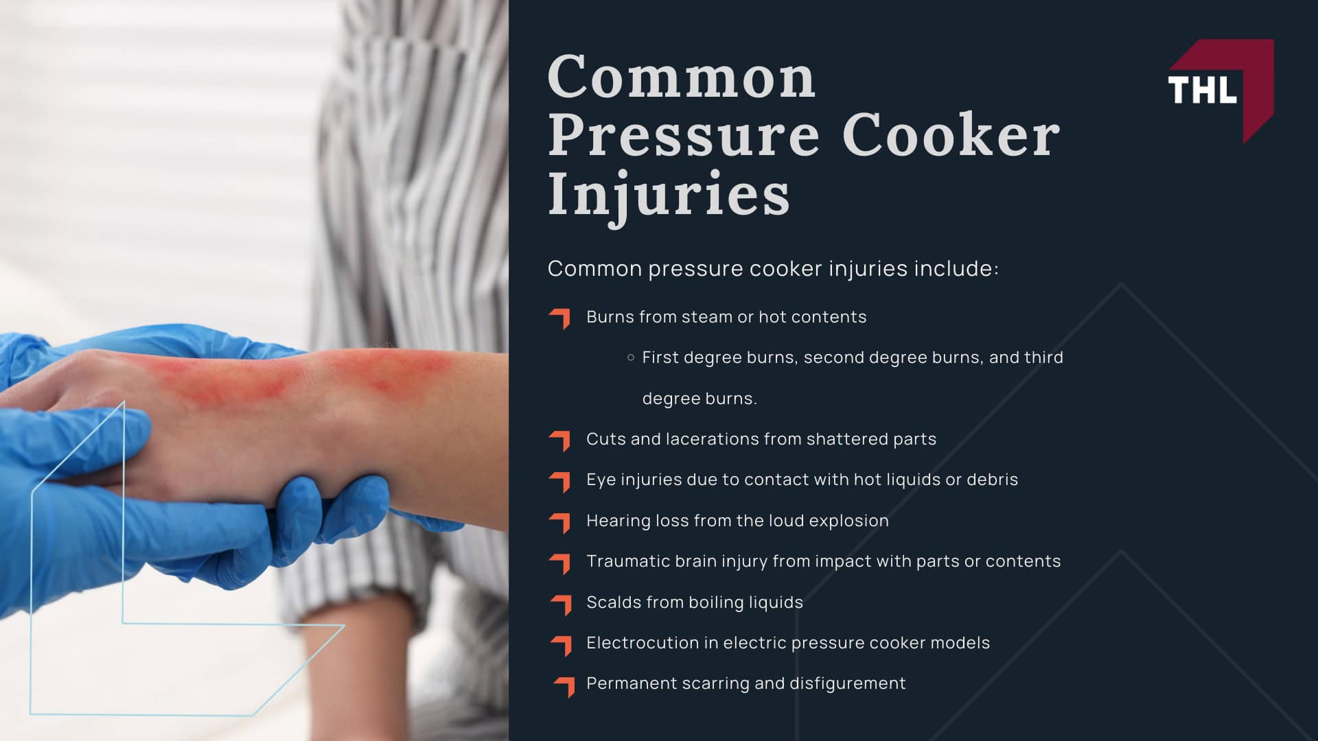 FAQ_ Can I File a Lawsuit for an Instant Pot Explosion_ - Lawsuits for Instant Pot Explosions_ An Overview; FAQ_ Can I File a Lawsuit for an Instant Pot Explosion_ - What is the Point of Filing an Instant Pot Lawsuit; How Do Pressure Cooker Explosions Occur; Common Defects in Faulty Pressure Cookers; Safety Mechanisms Introduced by Pressure Cooker Manufacturers; Common Pressure Cooker Injuries