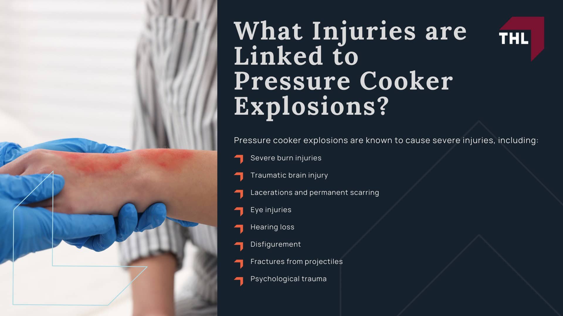 Defective Pressure Cooker Dangers & Injuries - Defective Pressure Cooker Dangers Explained - torhoerman law; Defective Pressure Cooker Dangers & Injuries - What Pressure Cooker Defects Can Cause Explosions_ - torhoerman law; Defective Pressure Cooker Dangers & Injuries - What Injuries are Linked to Pressure Cooker Explosions_ - torhoerman law