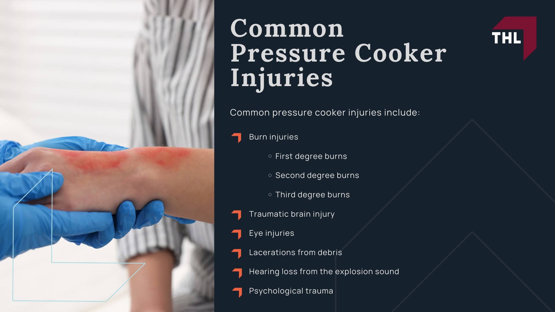 https://staging.torhoermanlaw.com/pressure-cooker-explosion-lawsuit/instant-pot-injury-lawsuit/; Exploding Pressure Cooker Causes, Compensation, & More - Common Pressure Cooker Injuries - torhoerman law