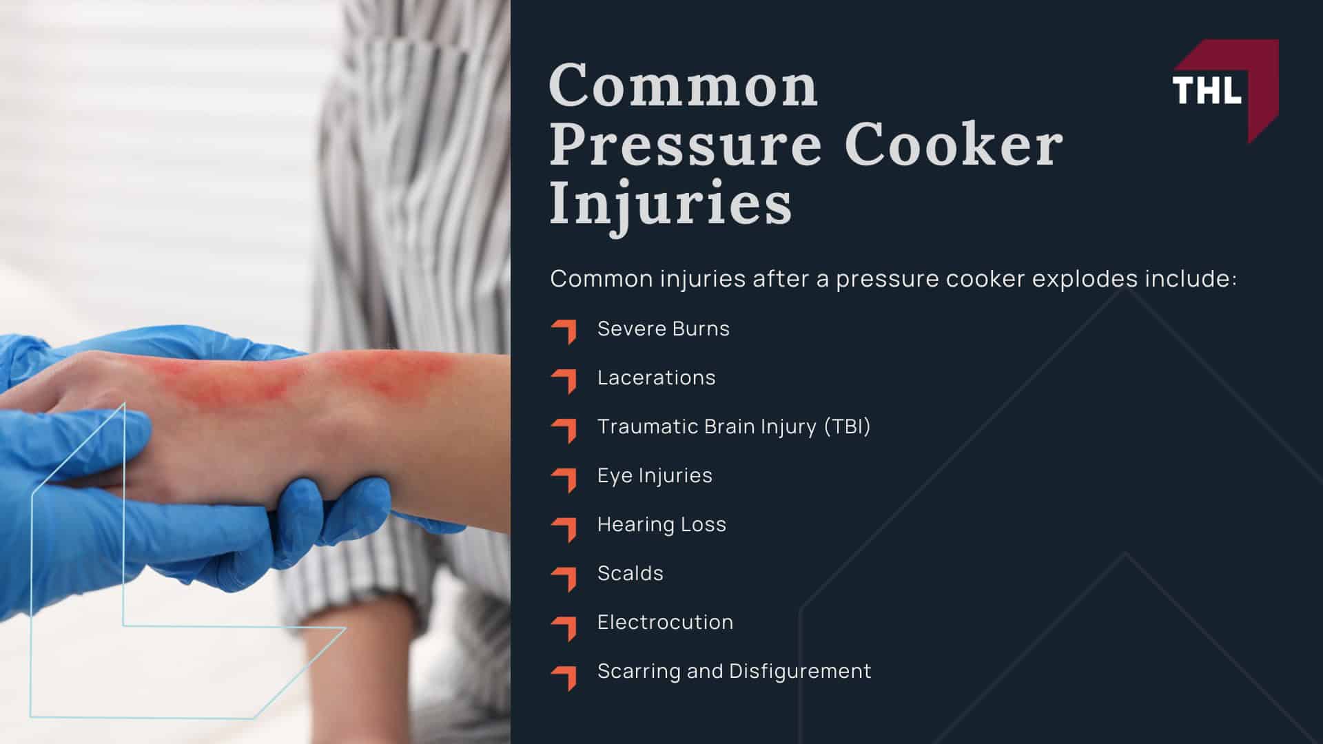  - torhoerman law; FAQ_ Why Do Pressure Cookers Explode_ - What To Do After a Pressure Cooker Explosion - torhoerman law; FAQ_ Why Do Pressure Cookers Explode_ - What Pressure Cookers Have Been Known to Explode_ - torhoerman law; FAQ_ Why Do Pressure Cookers Explode_ - Common Pressure Cooker Injuries - torhoerman law