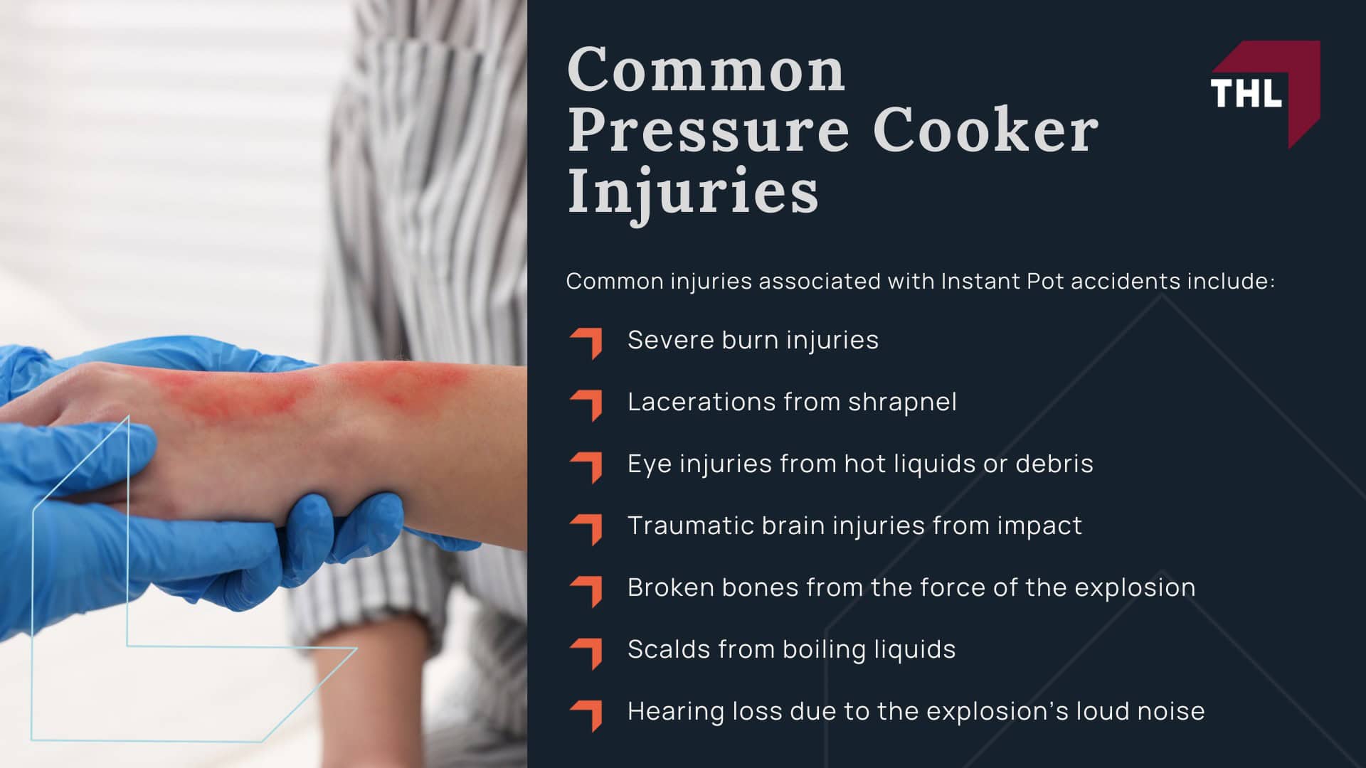 Instant Pot Injury Lawsuit - Legal Action for People Injured by Instant Pot Pressure Cookers - torhoerman law; Instant Pot Injury Lawsuit - Who Can File an Instant Pot Lawsuit_ - torhoerman law; Instant Pot Injury Lawsuit - How Does an Instant Pot Explosion Happen_ - torhoerman law; Instant Pot Injury Lawsuit - Common Pressure Cooker Injuries - torhoerman law