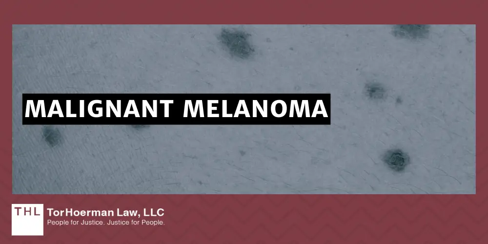 PCBs and Cancer; PCB Lawsuit; Monsanto PCB Lawsuit; Are PCBs Carcinogenic; Do PCBs Cause Cancer; PCB Exposure Lawsuit; Polychlorinated Biphenyls (PCBs) And Cancer; Mechanisms of Carcinogenesis How PCBs Cause Cancer; The Types Of Cancer Linked To PCB Exposures; Liver Cancer; Breast Cancer; Malignant Melanoma