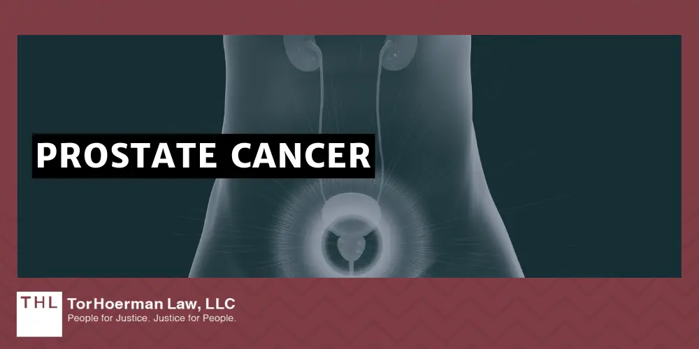 PCBs and Cancer; PCB Lawsuit; Monsanto PCB Lawsuit; Are PCBs Carcinogenic; Do PCBs Cause Cancer; PCB Exposure Lawsuit; Polychlorinated Biphenyls (PCBs) And Cancer; Mechanisms of Carcinogenesis How PCBs Cause Cancer; The Types Of Cancer Linked To PCB Exposures; Liver Cancer; Breast Cancer; Malignant Melanoma; Stomach Cancer; Intestinal Cancer; Thyroid Cancer; Non-Hodgkin's Lymphoma; Brain Cancer; Lung Cancer; Pancreatic Cancer; Prostate Cancer