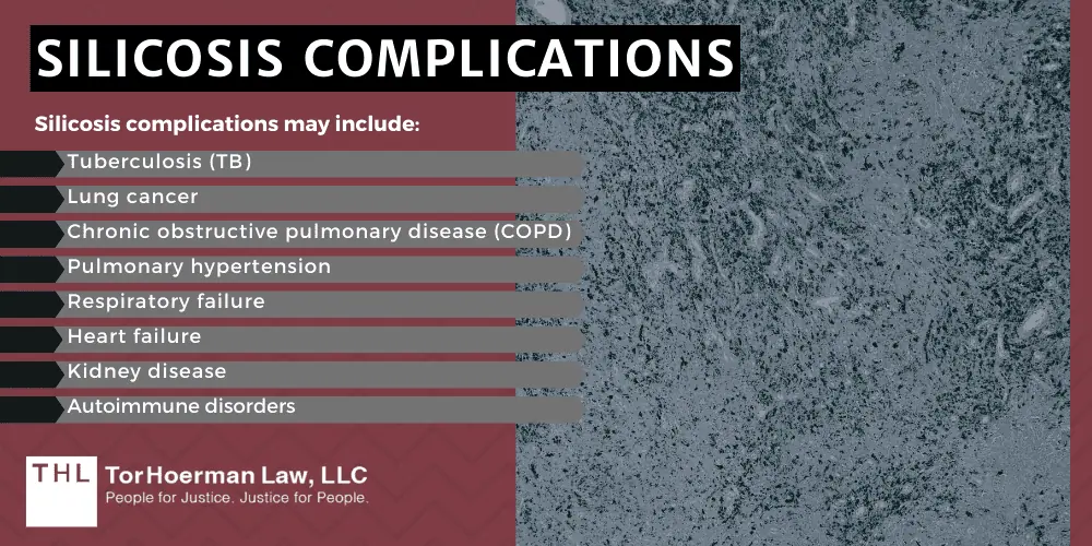 Silicosis Lawsuit; Silica Dust Exposure; Silica Exposure Lawsuit; Silica Lawsuit; Silicosis Lawsuit Overview; What Is The Average Silicosis Lawsuit Settlement Amount; Who Are Silicosis Lawsuits Filed Against;  Health Risks Of Silica Exposure; What Is Silicosis; Common Silicosis Symptoms; Silicosis Complications