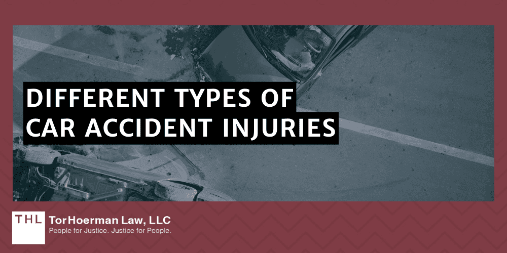 Different Types Of Car Accident Injuries