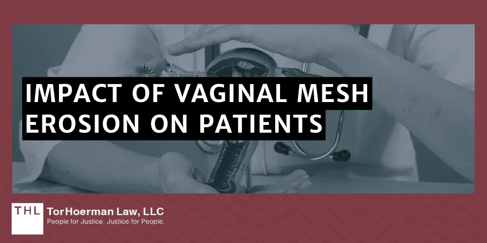 Vaginal Mesh Erosion Lawsuit; vaginal mesh erosion; vaginal mesh lawsuit; transvaginal mesh lawsuit; vaginal mesh complications; vaginal mesh pelvic pain; Vaginal Mesh And Its Uses; Vaginal Mesh Erosion; Impact Of Vaginal Mesh Erosion On Patients