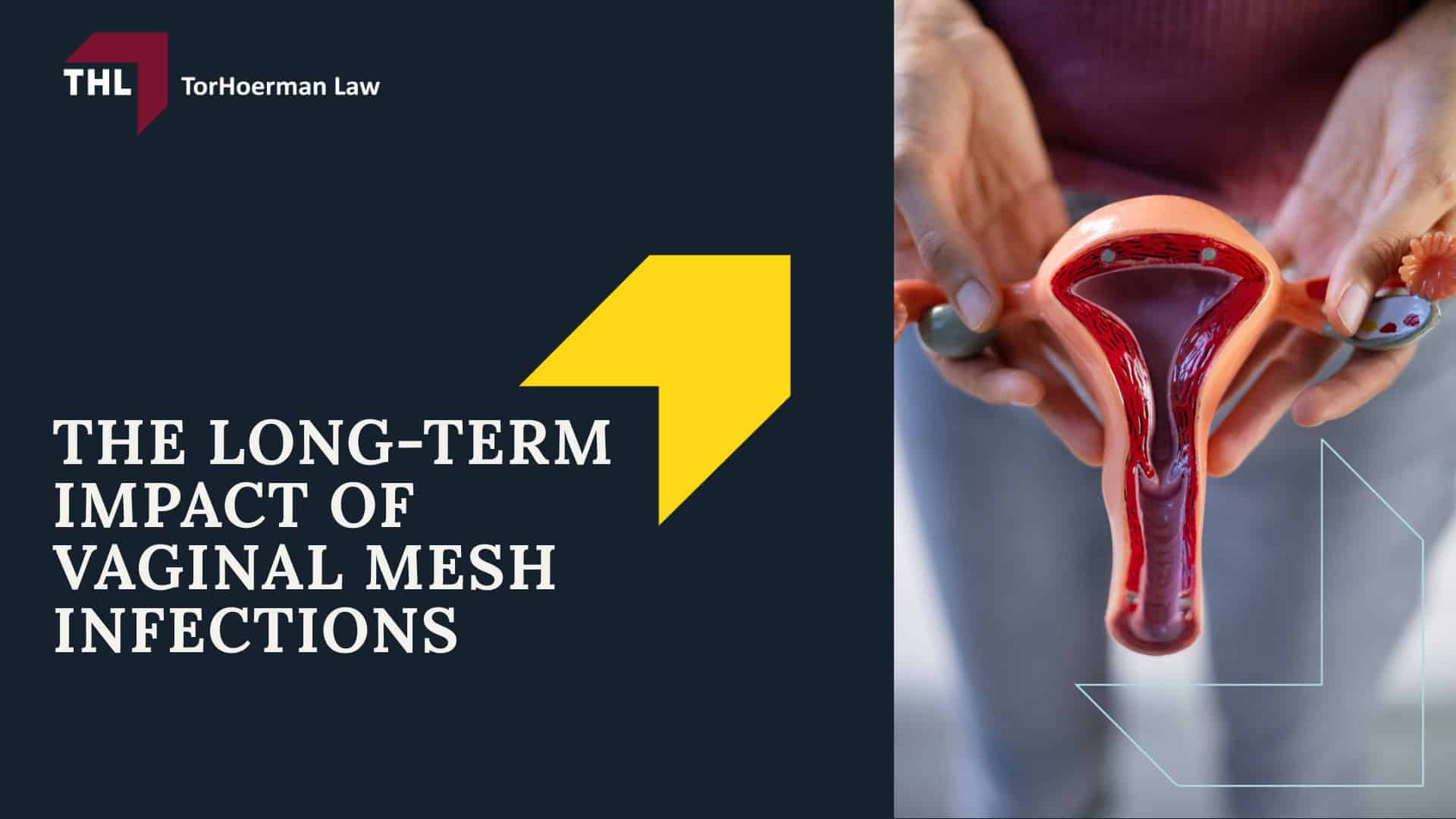 Vaginal Mesh Infection Lawsuit - What Is Vaginal Mesh - torhoerman law; Vaginal Mesh Infection Lawsuit - Pelvic Organ Prolapse (POP) - torhoerman law; Vaginal Mesh Infection Lawsuit - Stress Urinary Incontinence (SUI) - torhoerman law; Vaginal Mesh Infection Lawsuit - Understanding Vaginal Mesh Infection - torhoerman law; Vaginal Mesh Infection Lawsuit - Causes of Vaginal Mesh Complications That Lead to Infection - torhoerman law; Vaginal Mesh Infection Lawsuit - Symptoms of Vaginal Mesh Infection - torhoerman law; Vaginal Mesh Infection Lawsuit - The Potential Severity of Vaginal Mesh Infections - torhoerman law; Vaginal Mesh Infection Lawsuit - The Health Implications of Vaginal Mesh Infections - torhoerman law; Vaginal Mesh Infection Lawsuit - Necessary Medical Treatments - torhoerman law; Vaginal Mesh Infection Lawsuit - Potential for Recurring Infections - torhoerman law; Vaginal Mesh Infection Lawsuit - The Long-Term Impact of Vaginal Mesh Infections - torhoerman law