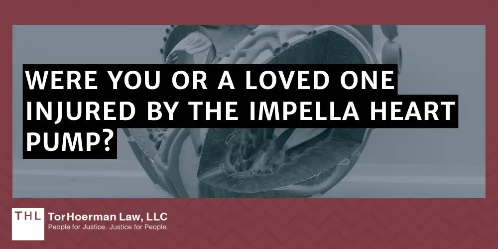 Impella 2.5
Impella CP
Impella CP with SmartAssist
Impella 5.5 with SmartAssist
Impella LD; Abiomed Impella Heart Pumps Recalled Due to Deaths and Serious Injuries; Impella Heart Pump Recalls And Regulatory Action (2023 & 2024); Abiomed Updates Patient Safety Instructions; About The Impella Heart Pumps; What Injuries Are Linked To The Abiomed Impella Heart Pump; How Are Impella Heart Pumps Causing Death; Were You Or A Loved One Injured By The Impella Heart Pump