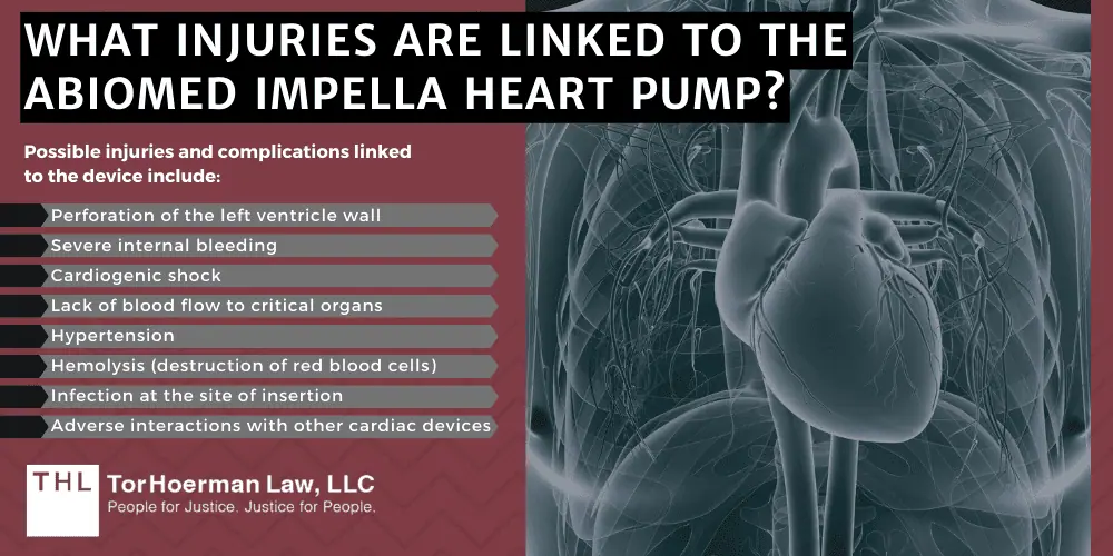 Impella 2.5
Impella CP
Impella CP with SmartAssist
Impella 5.5 with SmartAssist
Impella LD; Abiomed Impella Heart Pumps Recalled Due to Deaths and Serious Injuries; Impella Heart Pump Recalls And Regulatory Action (2023 & 2024); Abiomed Updates Patient Safety Instructions; About The Impella Heart Pumps; What Injuries Are Linked To The Abiomed Impella Heart Pump