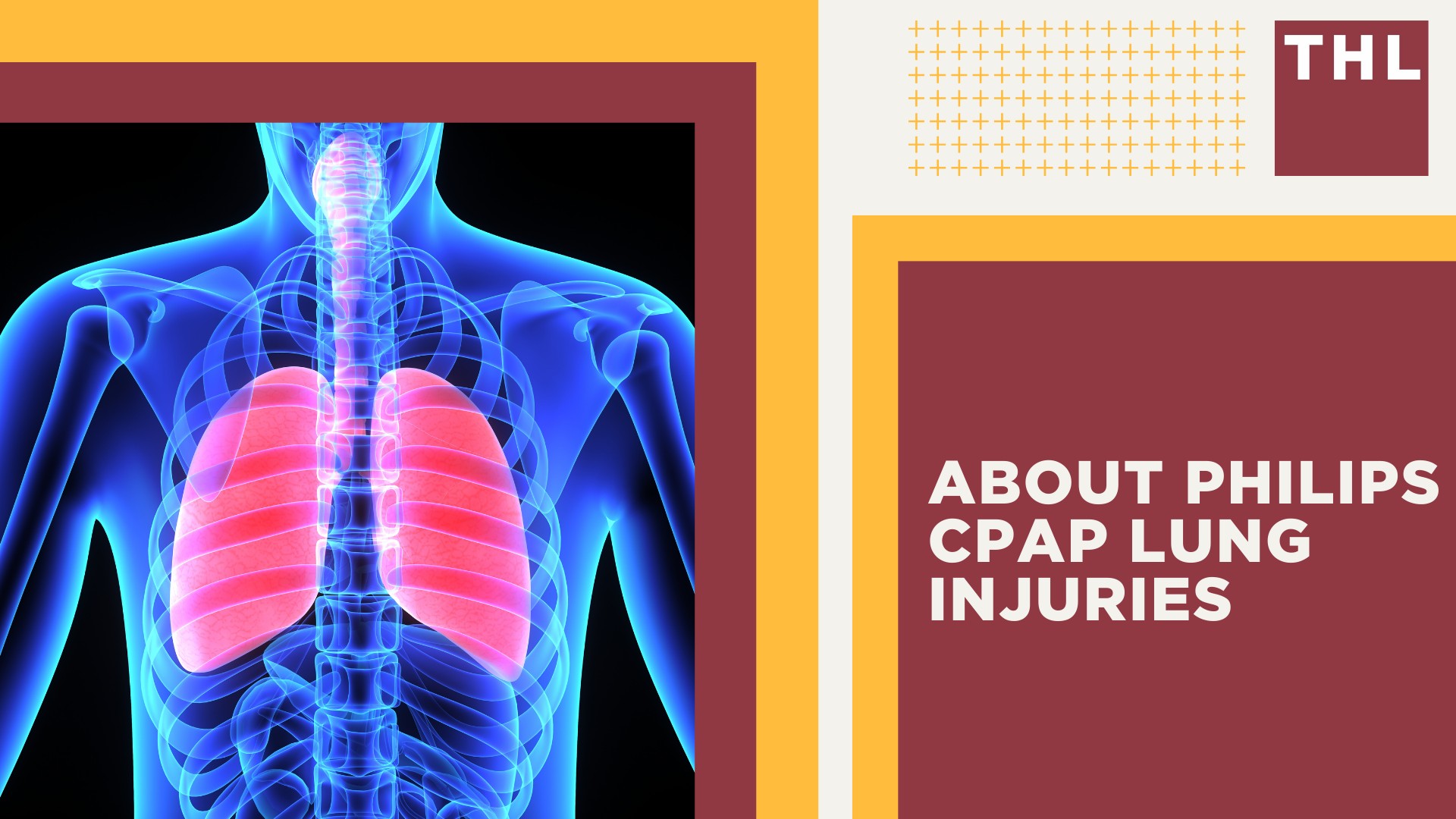 Health Risks Associated With Philips Respironics Devices; About Philips CPAP Lung Injuries