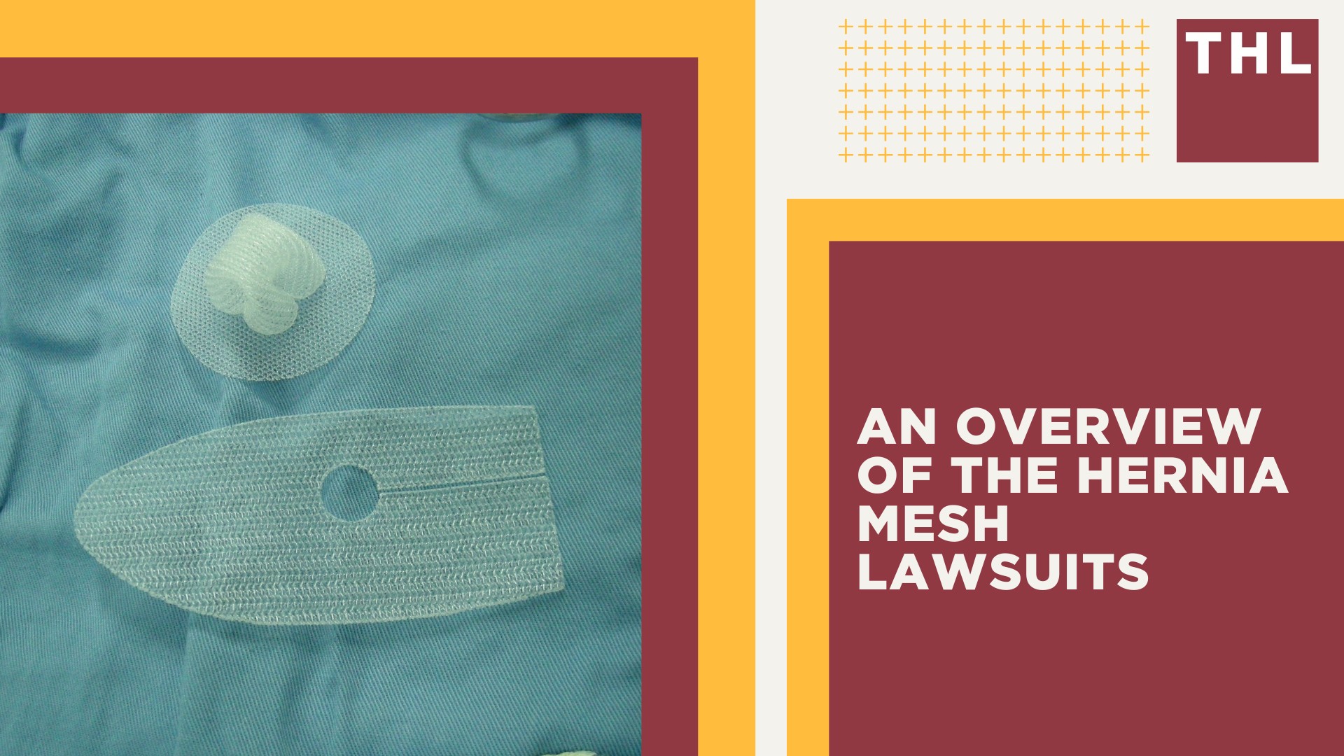 An Overview of the Hernia Mesh Lawsuits