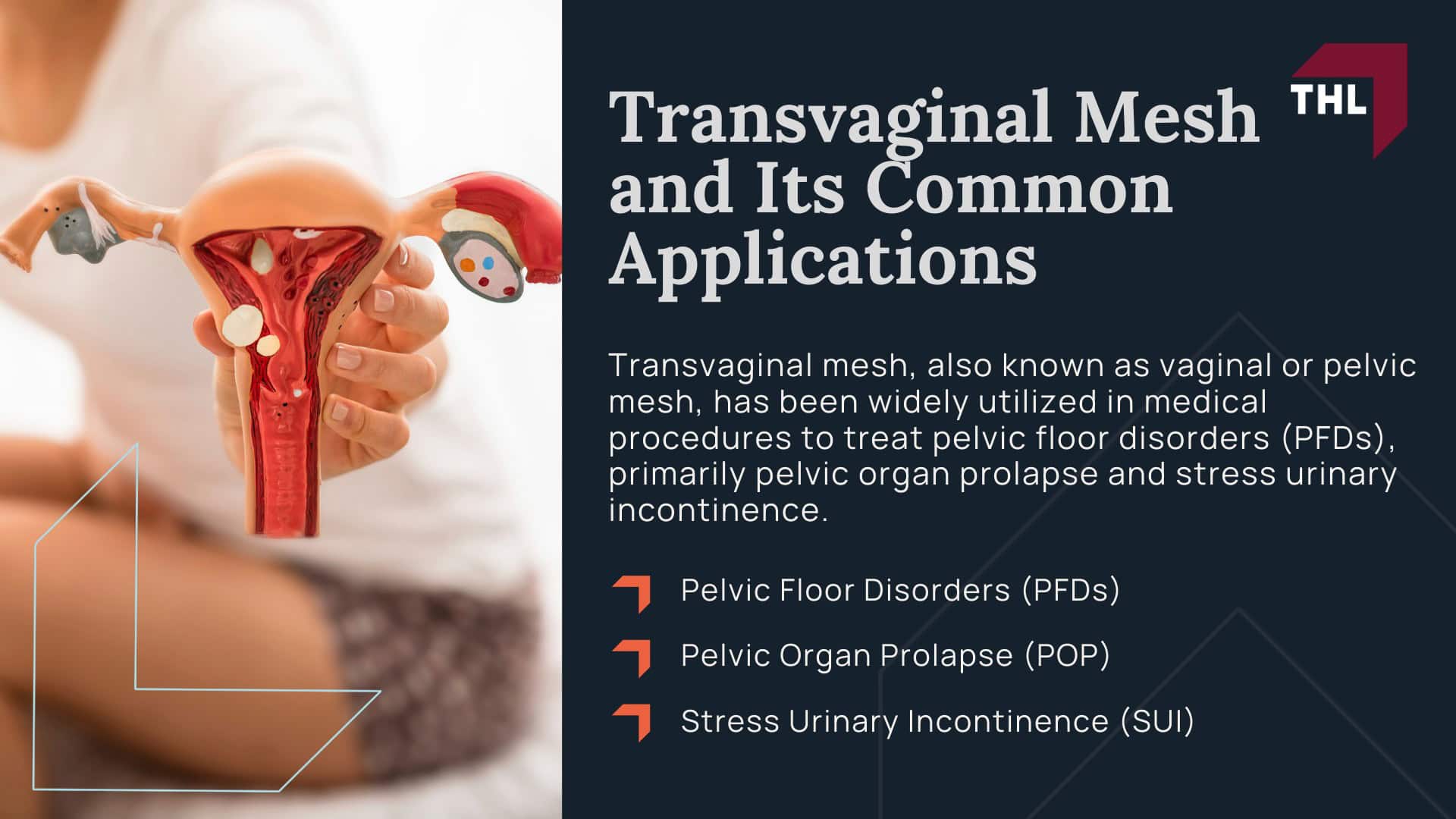 Vaginal Mesh Lawsuit Update - Transvaginal Mesh and Its Common Applications - torhoerman law