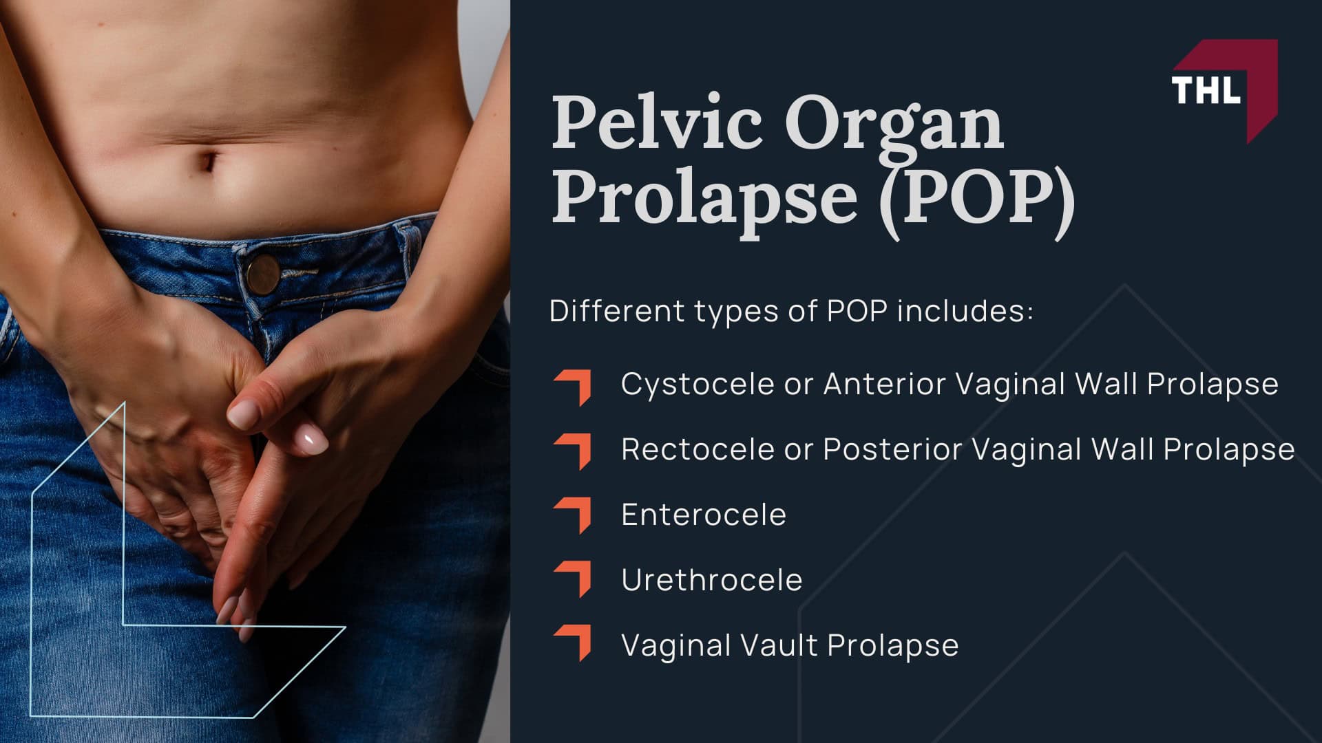 Vaginal Mesh Prolapse Lawsuit - The Rise of Surgical Mesh Devices - torhoerman law; Vaginal Mesh Prolapse Lawsuit - The Rise of Surgical Mesh Devices - torhoerman law; Vaginal Mesh Prolapse Lawsuit - Pelvic Organ Prolapse (POP) - torhoerman law