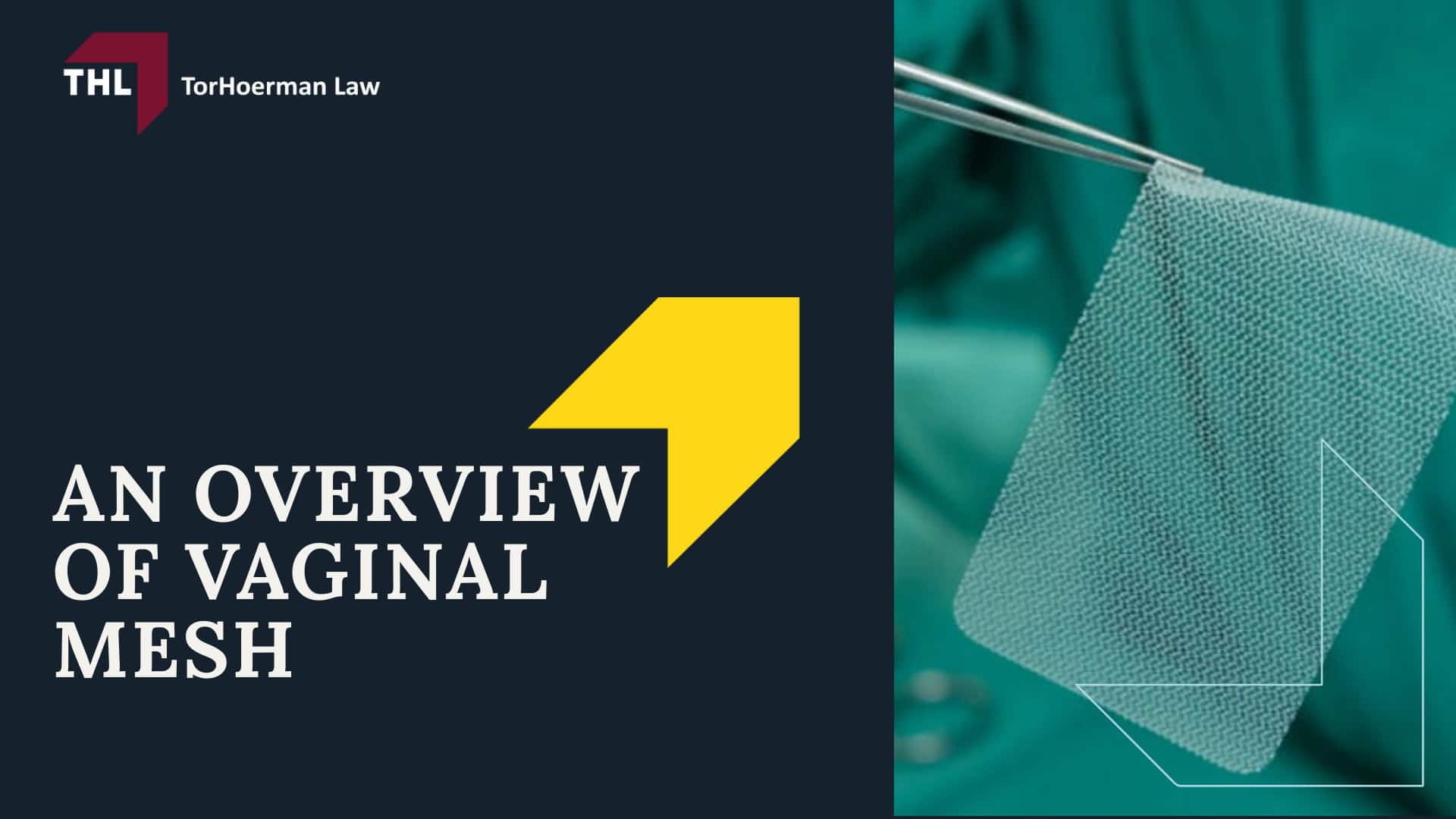 Vaginal Mesh Urinary Problems Lawsuit - An Overview of Vaginal Mesh - torhoerman law