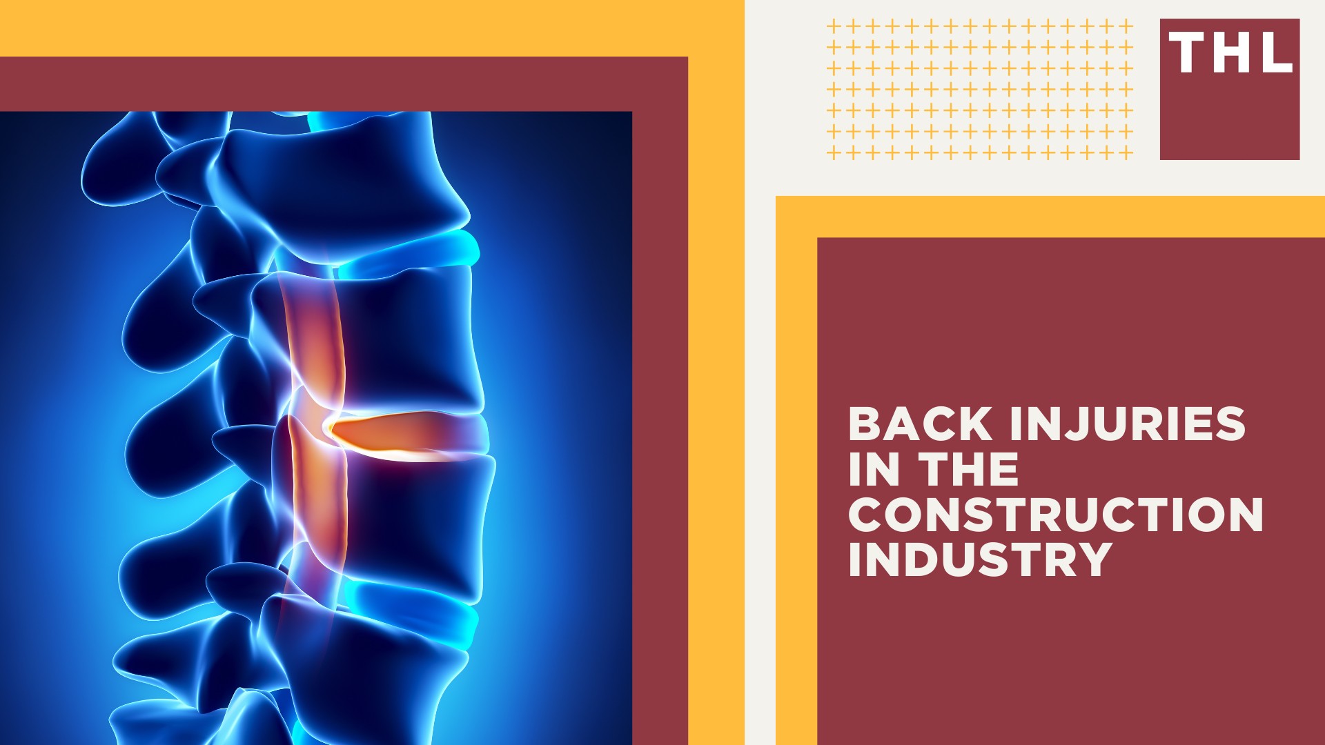 Back Injuries in the Construction Industry