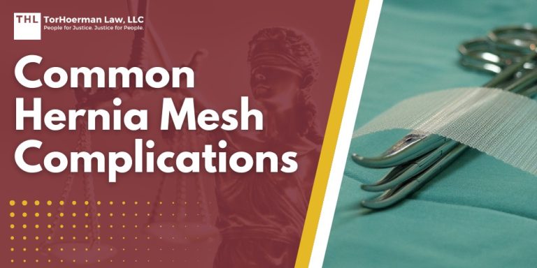 Common Hernia Mesh Complications